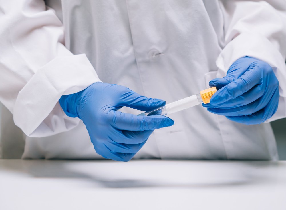 Espermograma em Manaus: onde realizar o exame para investigar a fertilidade masculina com segurança