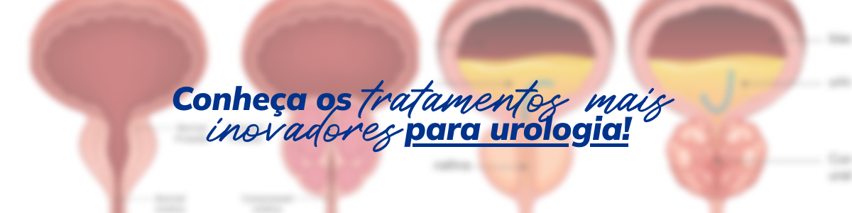 Cirurgia de cálculo renal em Manaus: tratamento especializado para eliminar pedras nos rins e no trato urinário