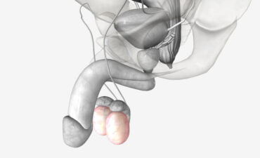 Cirurgia de prótese peniana em Manaus: recupere sua confiança com equipe especializada