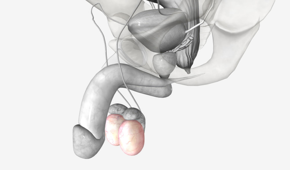 Cirurgia de prótese peniana em Manaus: recupere sua confiança com equipe especializada