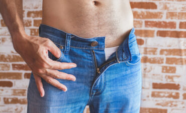 Harmonização peniana em Manaus: melhore aparência íntima com tecnologia e segurança