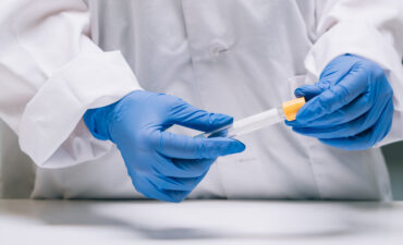 Espermograma em Manaus: onde realizar o exame para investigar a fertilidade masculina com segurança