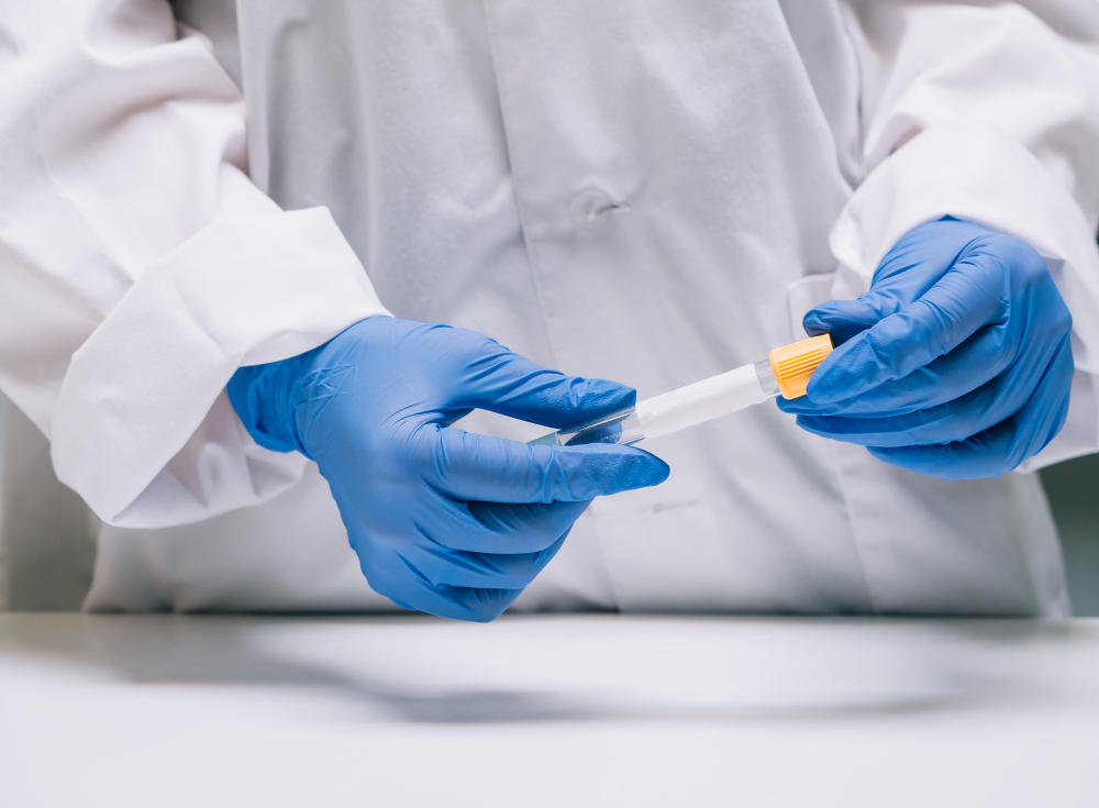 Espermograma em Manaus: onde realizar o exame para investigar a fertilidade masculina com segurança